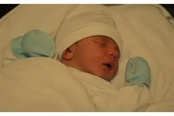 Bebeklerde Sarılık Belirtileri